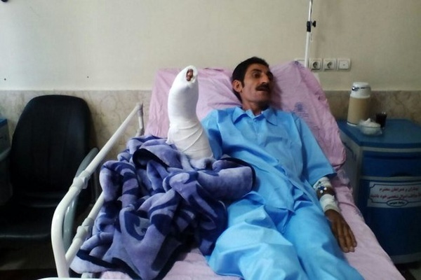 پیوند دست قطع‌شده از ساعد در بیمارستان شهدای عشایر