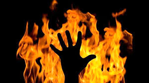 سوختگی 80 درصدی دختر 17 ساله دیشموکی  بخشدار دیشموک: خودسوزی را تایید نمی‌کنم