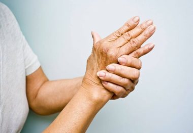 چند نکته ورزشی برای مبتلایان به آرتریت
