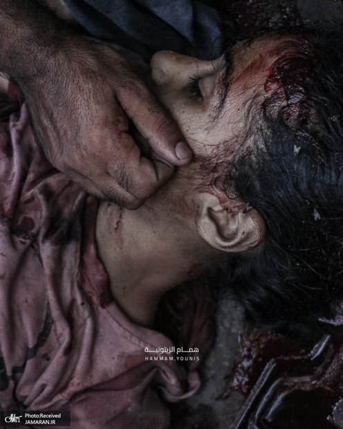 تصاویر دردناک/ شهادت غم‌انگیز دو کودک در آغوش هم در بمباران رژیم صهیونیستی