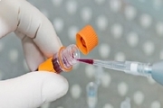 آزمایش سلول‌های خونی ظرف ۱۰ دقیقه با دستگاه ایرانی ممکن شد