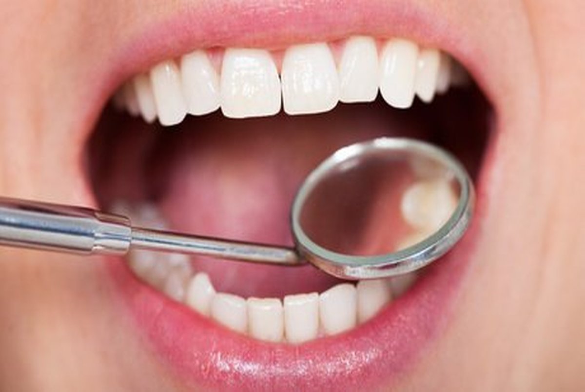 دندان‌ها می‌توانند خود را ترمیم کنند؟