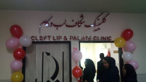 درمانگاه تخصصی شکاف لب و کام در بیمارستان ابوذر اهواز بهره‌برداری شد