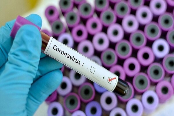 شناسایی ۱۷۰ مورد ابتلای جدید به ویروس کرونا در خوزستان