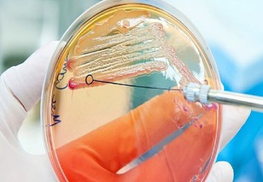 این آنتی‌بیوتیک با باکتری‌های خوب کاری ندارد
