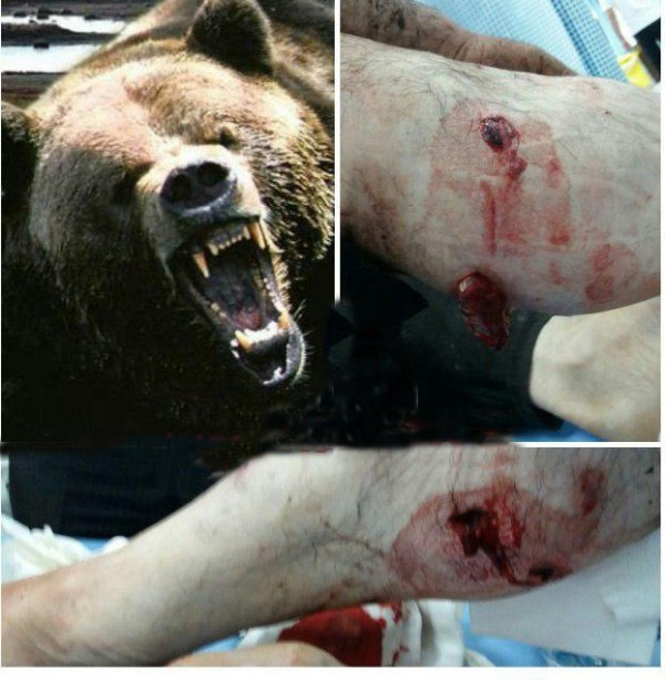 حمله خرس به کودک 10 ساله در چهارمحال و بختیاری