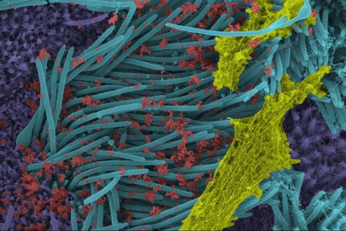 انتشار تصاویر سلول‌های آلوده به "کروناویروس سندرم حاد تنفسی ۲"