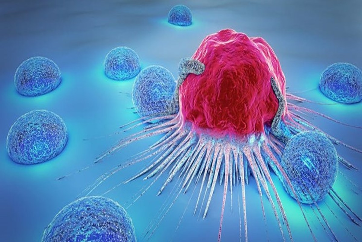 کدام نوع از سرطان‌ها قابل پیشگیری هستند؟
