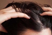 درمان های خانگی موهای آسیب دیده