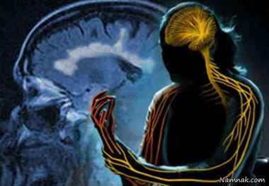 رابطه میان خستگی و بیماری ام اس
