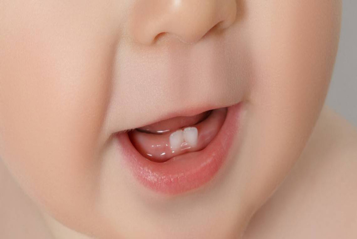 بوی بد دهان کودکان را جدی بگیرید