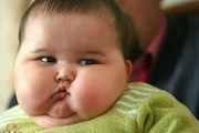  چاقی از اوایل کودکی نتیجه یک جهش ژنی است

