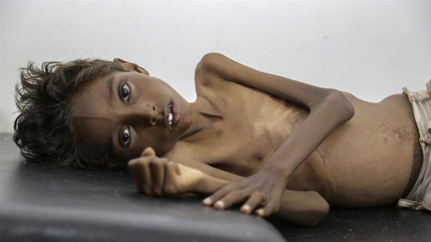جنگ 21 ماهه یمن و جهل جهانی از واقعیتی تلخ

