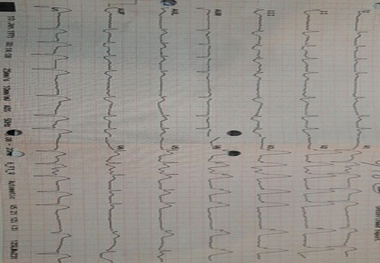 آقای 54ساله شهرکردی با دستان نجات بخش کارشناسان اورژانس115 به زندگی بازگشت