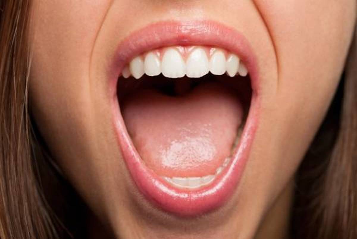شایع ترین نشانه های سرطان دهان
