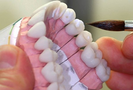دندانساز متخلف در قزوین به مراجع قضایی معرفی شد