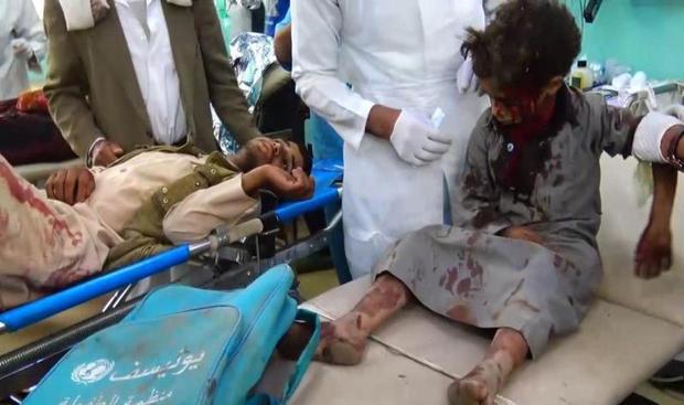 50 کشته و  77 زخمی در حمله عربستان به صعده یمن