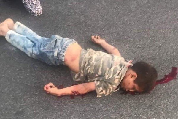 تصاویر دلخراش/ شهرک نشین صهیونیست کودک 6 ساله فلسطینی را زیر گرفت