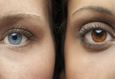 آرزوی چشم رنگی شدن؛ انتخاب بین نابینایی و زیبایی
