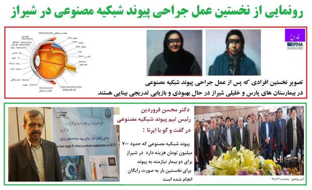 همایش رونمایی از نخستین عمل پیوند شبکیه در شیراز برگزار شد
