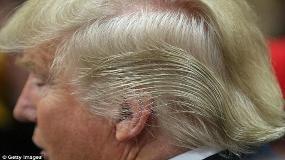راز موهای عجیب ترامپ