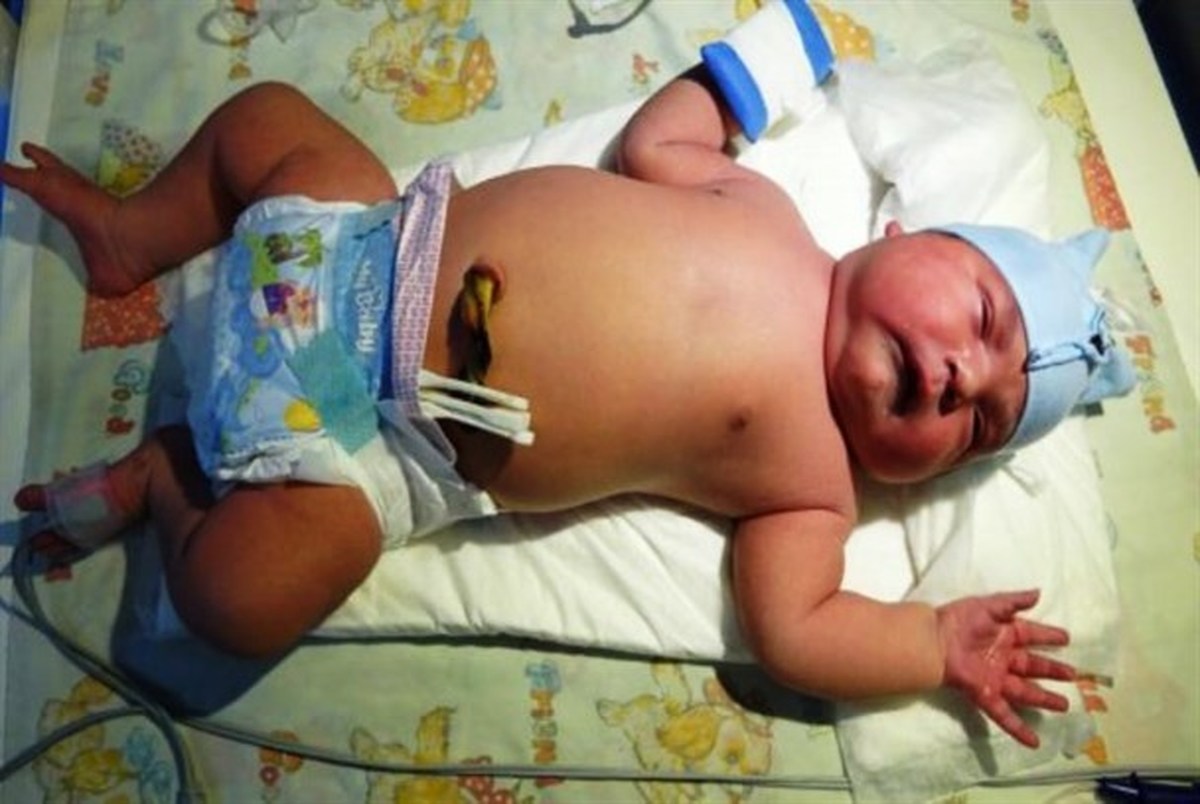 تولد نوزاد ۶ کیلویی در میاندوآب/ عکس