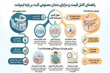 قیمت دندان مصنوعی ثابت بر پایه ایمپلنت چقدر است؟