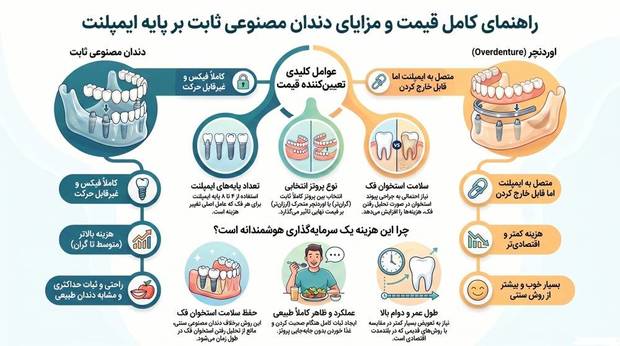قیمت دندان مصنوعی ثابت بر پایه ایمپلنت چقدر است؟