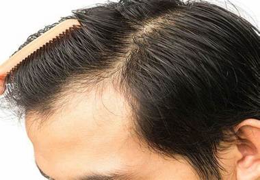 راهکارهای طب ایرانی کم هزینه برای تقویت مو