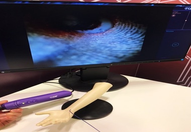 ابداع روش آندوسکوپی از رگ‌ها
