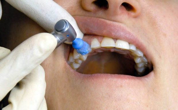 پوسیدگی دندان معضل جدی در استان مرکزی است