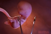 ۱۳۷ مجور سقط جنین در لرستان صادر شد