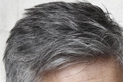  راه‌های جلوگیری از سفید شدن موها