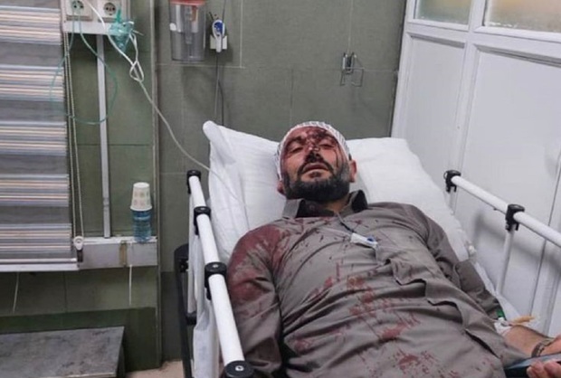 جزییات حمله به شهردار ناحیه 3 منطقه 19 تهران + تصاویر