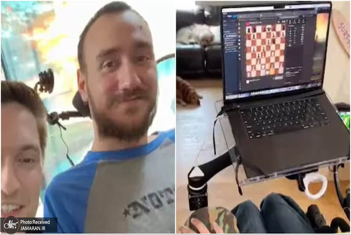 دستاورد مهم: بیمار معلول "نورالینک" ازطریق افکارش شطرنج بازی می‌کند + عکس