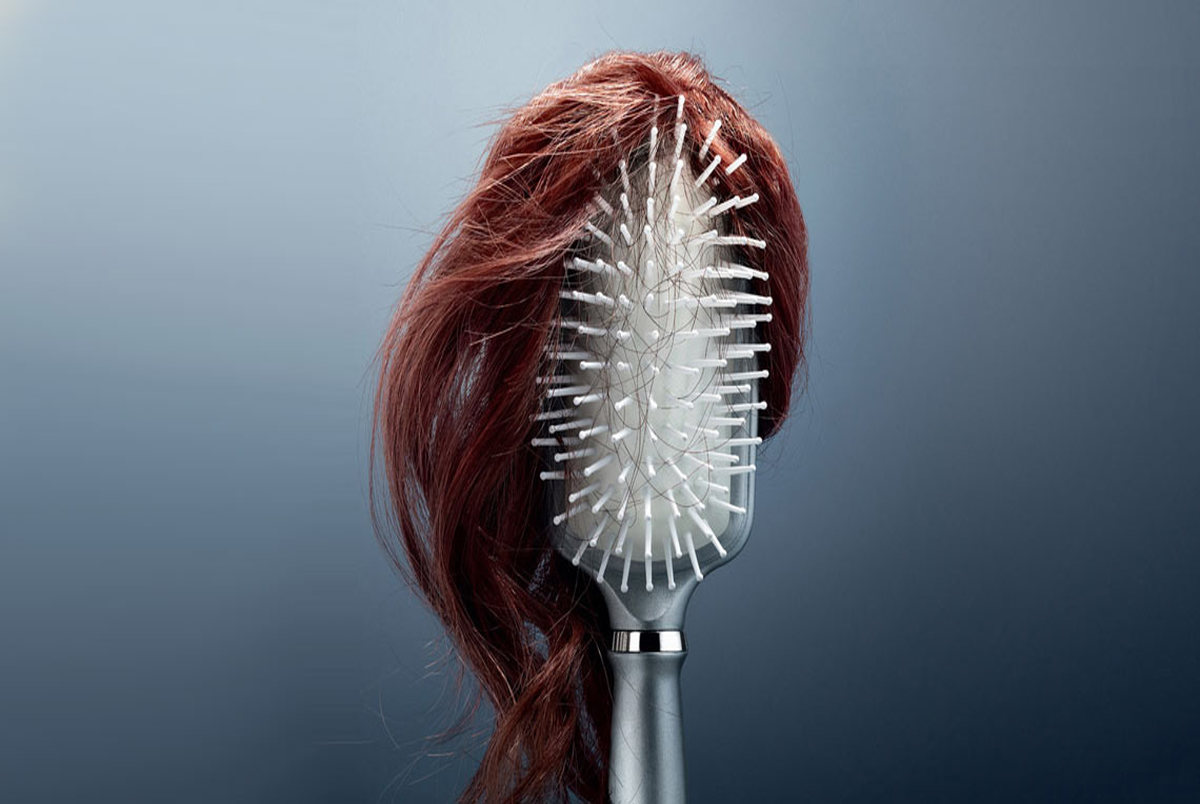 ریزش مو در زنان نشانه مشکلات بزرگ تری است؟
