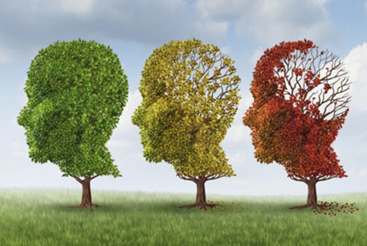 راهکار جدید محققان برای پیشگیری از آلزایمر