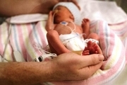 پیشرفت‌های بهداشتی امکان بقای نوزادان نارس را افزایش داده است