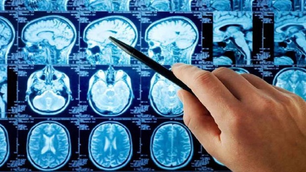 بازسازی تصاویر دقیق از فعالیت مغز با هوش مصنوعی
