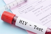 درصد مبتلایان به ایدز در چنارمحمودی اعلام شد