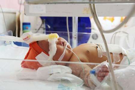 تولد نوزاد 6 کیلو و 100گرمی در بیمارستان کنگان بوشهر
