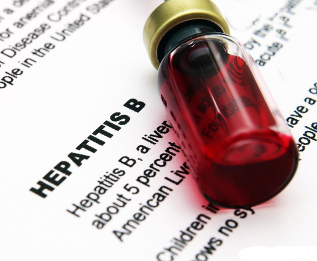 هپاتیت در کمین علائم سرماخوردگی های ساده را دست کم نگیریم