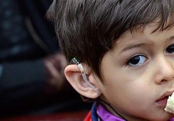 هدفگذاری برای ایران عاری از ناشنوا تا 10 سال آینده  درمان کودکان ناشنوا نیاز به تامین ارز دارد