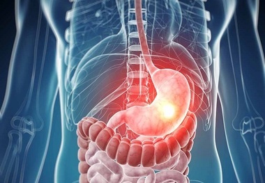 ۸ عادت بد و رایج که معده را از بین می‌برند
