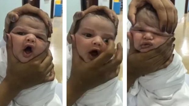 اخراج پرستاران عربستانی به دلیل کودک آزاری + عکس