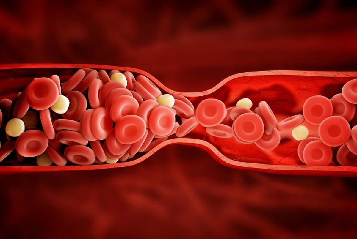 تعداد گلبول های قرمز خون چگونه افزایش دهیم؟