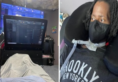 این بیماری با چشم خود موسیقی می سازد!
