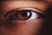 ۵ علت رایج قرمزی چشم+روش درمان و زمان مراجعه به پزشک