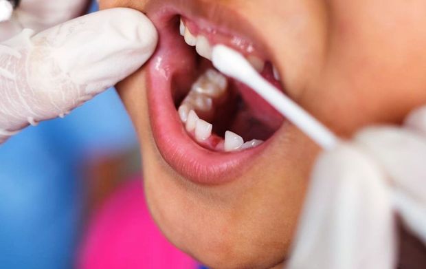 سلامت دندان دانش آموزان،اولویت دانشگاه علوم پزشکی شیراز است