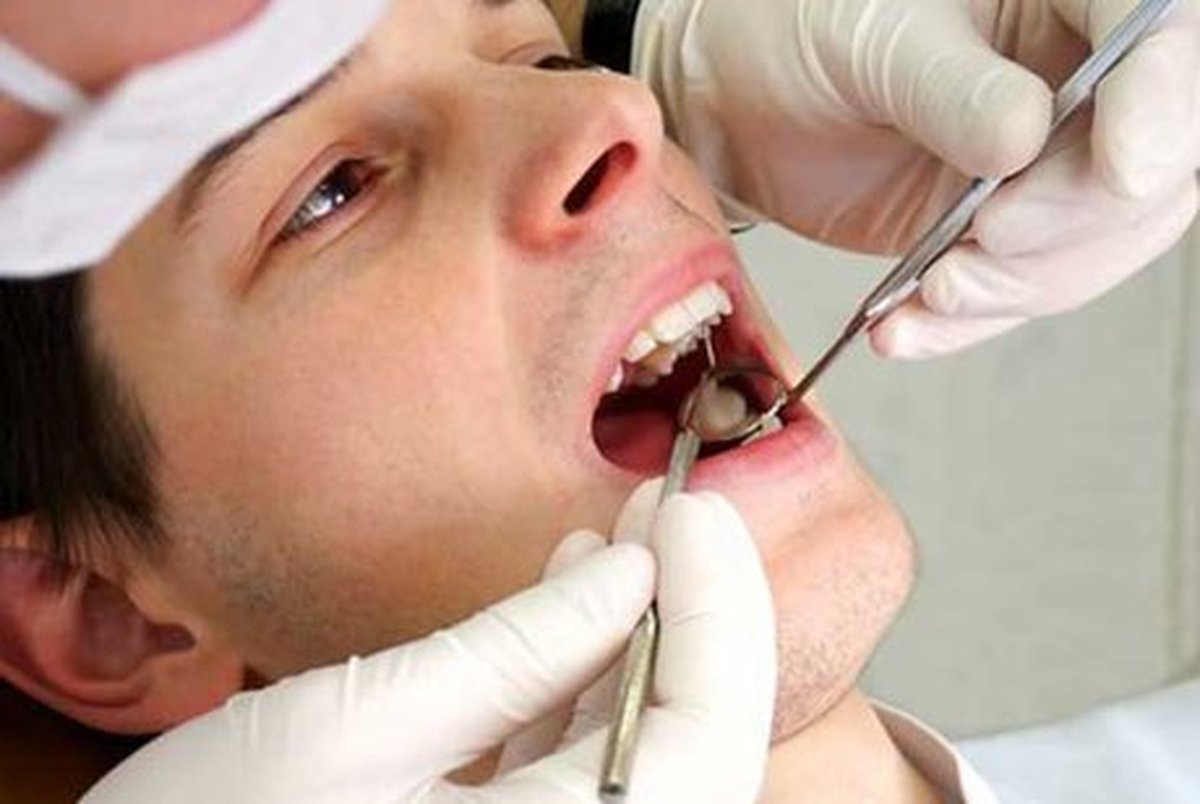ترکیب معجزه‌گر برای ترمیم دندان‌های پوسیده